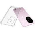 bizon-case-salpa-honor-200-clear-06.jpg